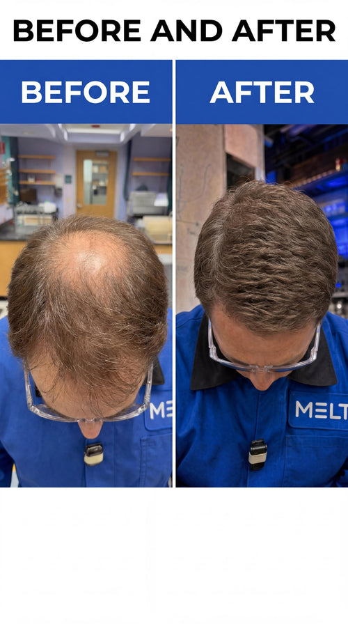 Formula PM15- Hair Restoration Breakthrough